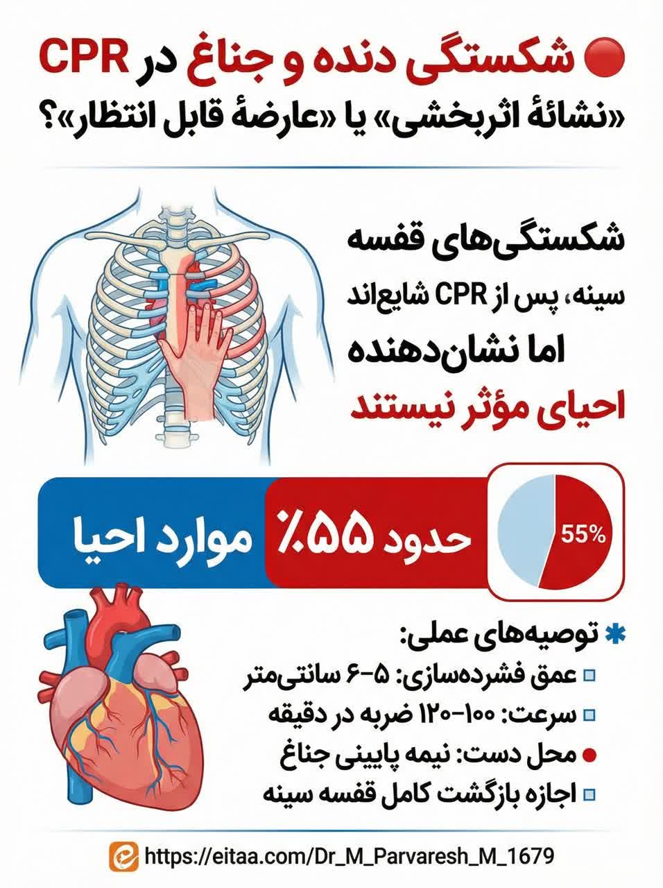 شکستگی دنده و جناغ در CPR 2025